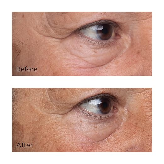 Firming & Lifting Eye Serum